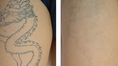 2023年鄭州整形醫(yī)院最新推薦！天后、華領(lǐng)、美萊等全面介紹！