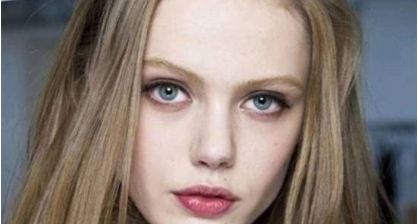 北京著名整形專家王光輝展示雙眼皮術(shù)的絕美案例，讓您了解如何變美的方法