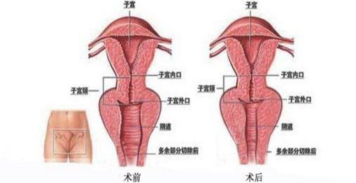 上海九院哪里能夠得到專業(yè)的隆鼻手術(shù)？排行榜最新推薦五位頂尖隆鼻專家