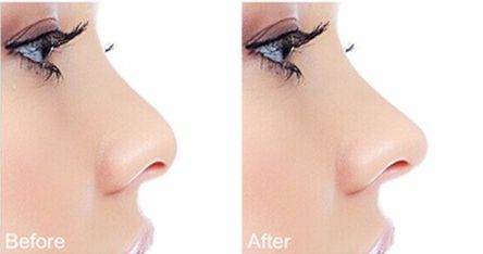 廣西愛(ài)思特劉曉軍耳再生費(fèi)用、技術(shù)詳解！優(yōu)勢(shì)特點(diǎn)一覽！