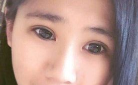 羅飛彪醫(yī)生開展的鼻子整形手術(shù)，售價(jià)一覽表，各種風(fēng)格任你挑選！