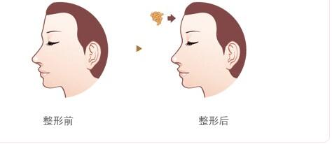 綿陽碧蓮盛植發(fā)醫(yī)院的效果如何？如何查詢地址及醫(yī)生信息？