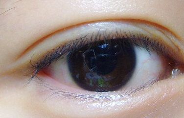 深圳醫(yī)療美容整形醫(yī)院有一位優(yōu)秀的醫(yī)生，張華彬醫(yī)生給你帶來(lái)精彩的案例分享！