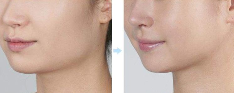 成都整形醫(yī)院揭曉：這五家醫(yī)院獲得排名前列！