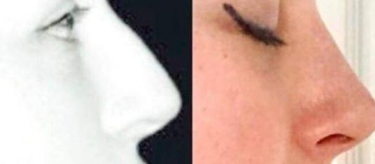 杭州整容醫(yī)生：陳小平、曾海峰長(zhǎng)期位居榜首