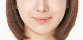 胡小芮寧夏醫(yī)科大學(xué)附屬醫(yī)院：醫(yī)療機(jī)構(gòu)概況及雙眼皮修復(fù)案例分享