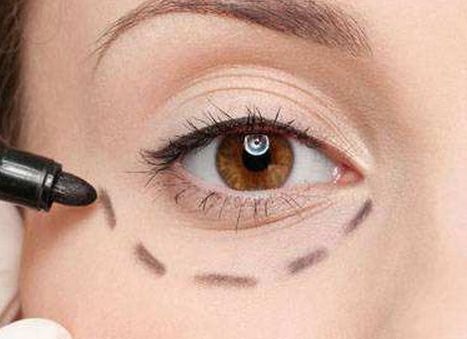 唐山優(yōu)秀雙眼皮修復醫(yī)生口碑盤點，案例分析、價格透明