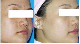 成都圣丹福賀忠波隆胸術(shù)實(shí)踐回顧，驚人成效曝光！