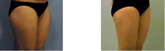 沈陽雙眼皮整形醫(yī)生哪位技術(shù)出眾？受歡迎的三位醫(yī)師推薦2023