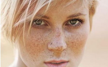 青州人民醫(yī)院美容科，了解一下主任介紹丨2023價格表丨激光祛痘案例排行