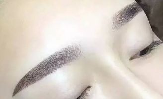 杜園園2023年雙眼皮修復(fù)案例揭秘，浦東區(qū)獨(dú)家經(jīng)驗(yàn)分享