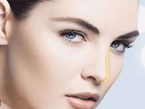 煙臺曹品根醫(yī)生的雙眼皮修復經(jīng)驗揭秘，90天修復案例全記錄