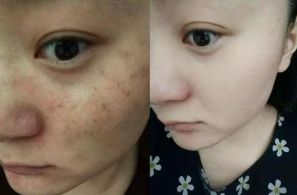 廣州微整形醫(yī)院專業(yè)排行，實(shí)力強(qiáng)勁，競(jìng)技大比拼！尋找您理想之選