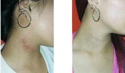 全國各大醫(yī)院推薦！拉皮手術(shù)高水平醫(yī)院盤點