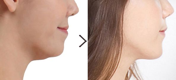 整形美容院選擇指南：華美、珍潤、藍(lán)山等品牌綜合比較，價格一覽表！