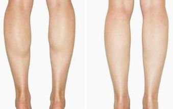 探尋南山整形醫(yī)院實力！醫(yī)生陣容揭秘+雙眼皮整形案例賞析