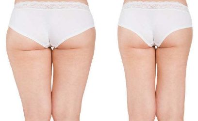 驚喜來襲！武漢葉子醫(yī)療美容醫(yī)院帶來全新鼻子塑造效果圖！