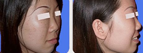 上海九院某醫(yī)生空前火爆！有幸親歷他的高超吸脂術(shù)！價(jià)格一覽來啦！