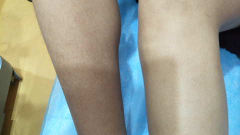 湘西自治州人民醫(yī)院燒傷美容整形科是否能滿足療效和口碑的雙重期望？有哪些備受推崇的醫(yī)生值得推薦？