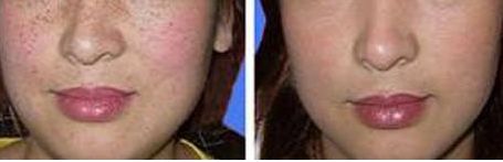 龍崗中心醫(yī)院整形科的雙眼皮修復(fù)醫(yī)生怎么樣？