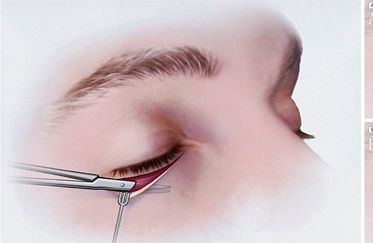 鼻部整形專家推薦：北京伊萊美哪位醫(yī)生技術(shù)一流？王冀耕、李旭東等好評(píng)如潮！