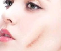 北京雙眼皮技術(shù)出色的醫(yī)院榜單，手術(shù)滿意度高贊醫(yī)院共享