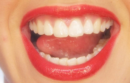 海南伊佳美容整形醫(yī)院好評(píng)如潮嗎？效果如何？