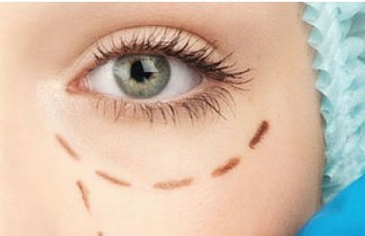 2023年首都北京近視手術(shù)醫(yī)生排行曝光！全面評(píng)估：口碑價(jià)位詳解，助你找到最佳矯正方案！