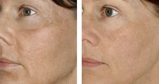 遼陽市中心醫(yī)院整形科：走進(jìn)這里，發(fā)現(xiàn)醫(yī)療奇跡！科室情況一覽