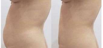 全國鼻子整形醫(yī)院排名揭曉，這幾家醫(yī)院上榜！