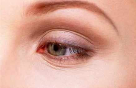 北京中月宏醫(yī)療整形美容醫(yī)院資質(zhì)如何？醫(yī)生團(tuán)隊(duì)是否專(zhuān)業(yè)可靠？醫(yī)院口碑怎么樣？