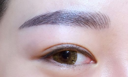 徐利剛：杭州藝星整形臨床實(shí)力派！鼻子整形解析，案例詳解！