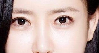 益陽市中心醫(yī)院整形科去除眼袋獨創(chuàng)新方式2023案例解析