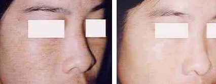 福州美貝爾醫(yī)療美容門(mén)診部：薛欣醫(yī)生用戶(hù)評(píng)價(jià)高？真實(shí)案例分享！