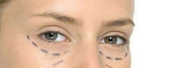 重慶德龍整形醫(yī)院推出先進技術(shù)，助您實現(xiàn)完美雙眼皮!