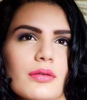 王太玲雙眼皮修復(fù)前后效果展示，讓您信心重拾！