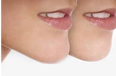 成都頂尖的玻尿酸注射醫(yī)生排行榜，六位信譽(yù)好的醫(yī)生介紹