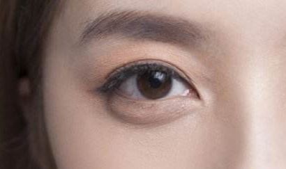 2023最新！精彩譚謙雙眼皮案例大揭秘，實(shí)景術(shù)后反饋引爆網(wǎng)絡(luò)