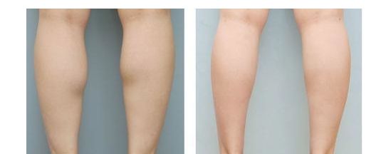 尋找蘇州市最佳雙眼皮整形醫(yī)生，專(zhuān)家排行榜最新發(fā)布