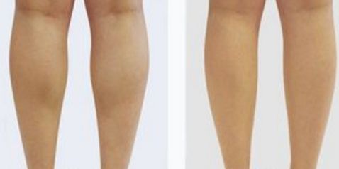 北京八大處楊欣好評傳遍朋友圈！揭秘90天顛覆性隆鼻之旅