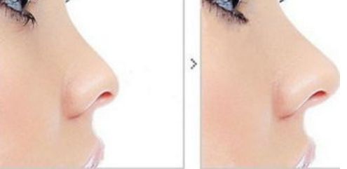 2023成都整容醫(yī)院推薦！聚焦四川友誼、軍大等優(yōu)質(zhì)選擇