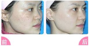 榆林二院整形科值得信賴嗎？醫(yī)生專業(yè)，雙眼皮案例豐富，收費(fèi)明明白白，專家指南！