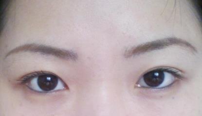 北京明會紅醫(yī)療美容診所價格表真實嗎？你會不會覺得有點匪夷所思？