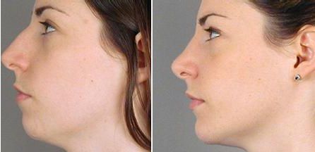 廣州熱瑪吉治療中心排行揭曉！醫(yī)院熱門榜單直擊