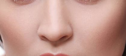 李湘源隆鼻案例，技術(shù)與反饋圖及價(jià)格表分享！