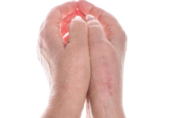 趙宏武醫(yī)療美容效果如何？是醫(yī)生水平真的經(jīng)得起點評嗎？