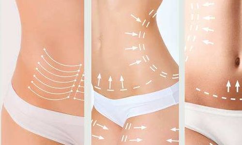 2023年武漢吸脂抽脂醫(yī)生（專家）技術(shù)分享：張軍、張繼強(qiáng)、劉洋等探討