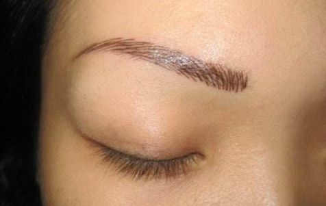 上海伯思立王艷隆鼻效果怎么樣？肋軟骨隆鼻真實(shí)案例及收費(fèi)一覽