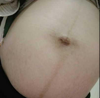 揭示濰坊市熱門隆鼻醫(yī)院排行榜！尋找濰坊隆鼻首選醫(yī)療機構TOP10！