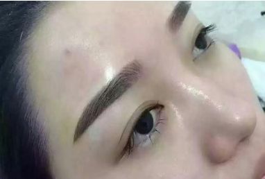 成都哪些整形醫(yī)院在皮膚美容領(lǐng)域具備優(yōu)勢(shì)？